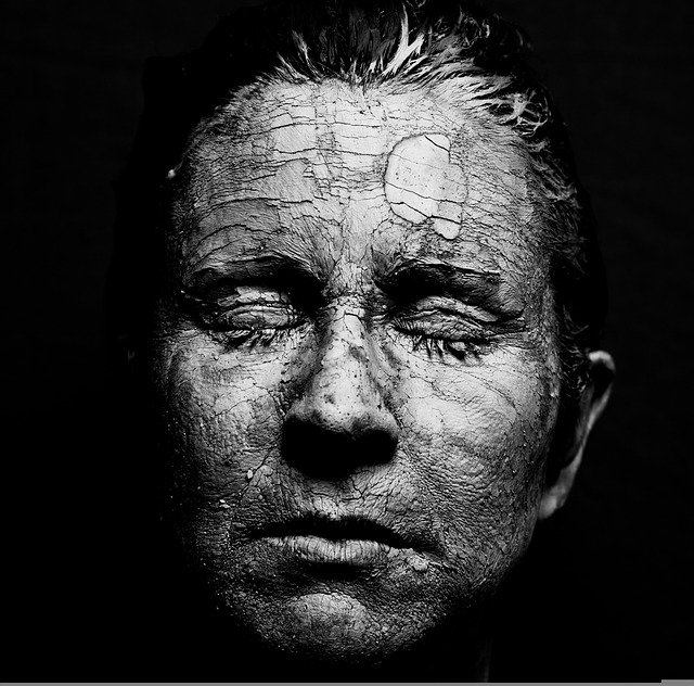 woman, dry skin, face