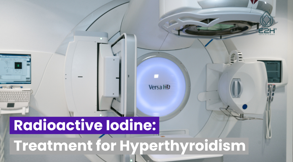 Radioactive Iodine Treatment for Hyperthyroidism