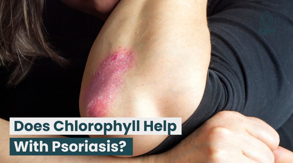 Does Chlorophyll Help With Psoriasis?