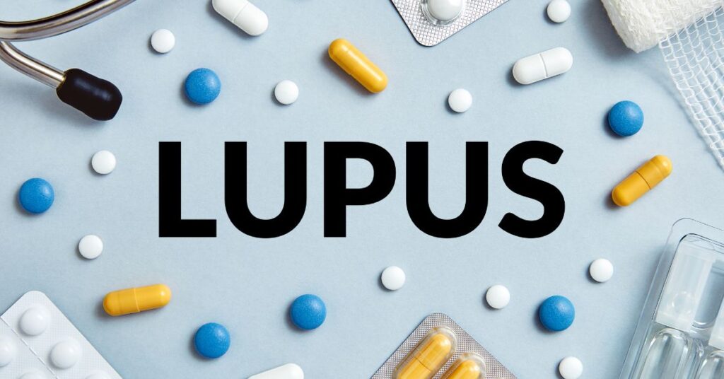 systemic lupus erythematosus diagnosed